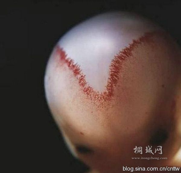 9�ܺ� V��Ѫ����ͷ���ڻ㴦������